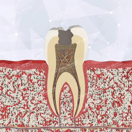 Развитие пульпита зуба