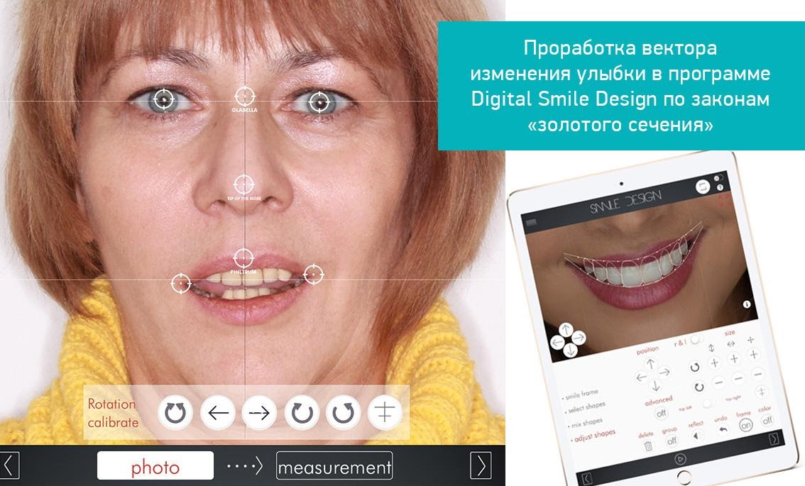 Создание улыбки в программе