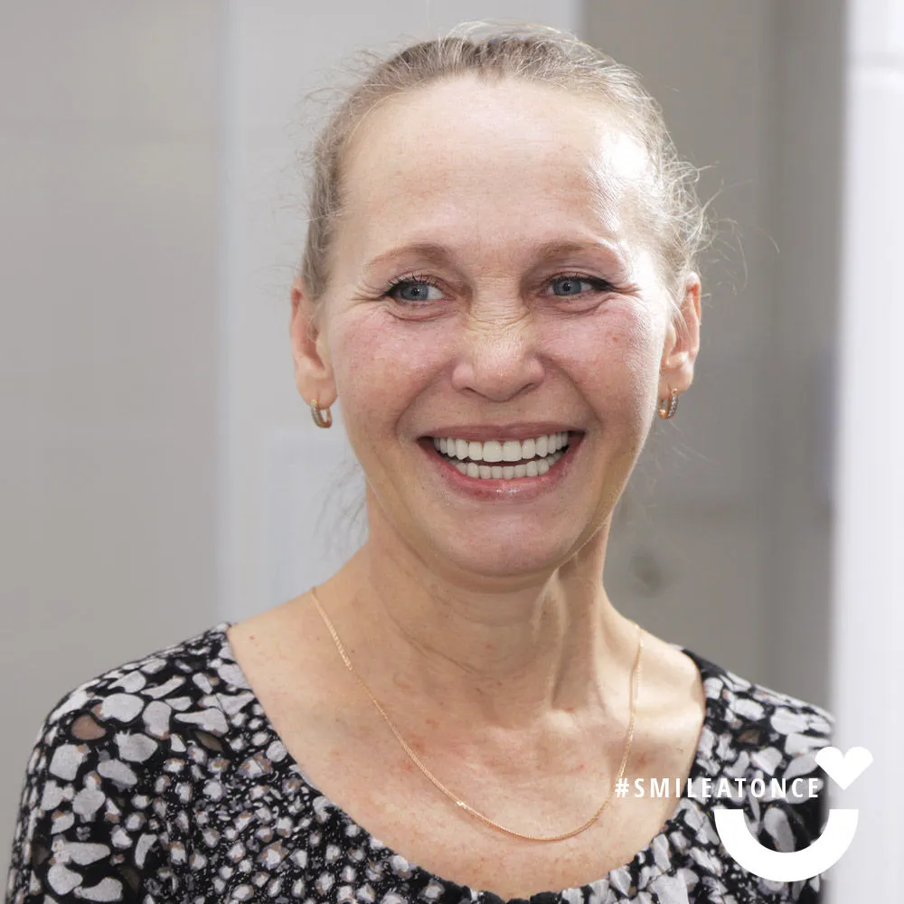 Рыкова Татьяна после установки постоянного протеза