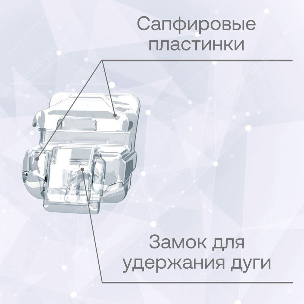 Устройство сапфирового брекета