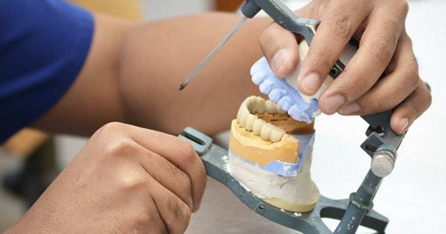 изготовление зубного протеза