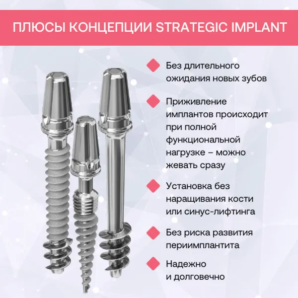 плюсы имплантации strategic implant