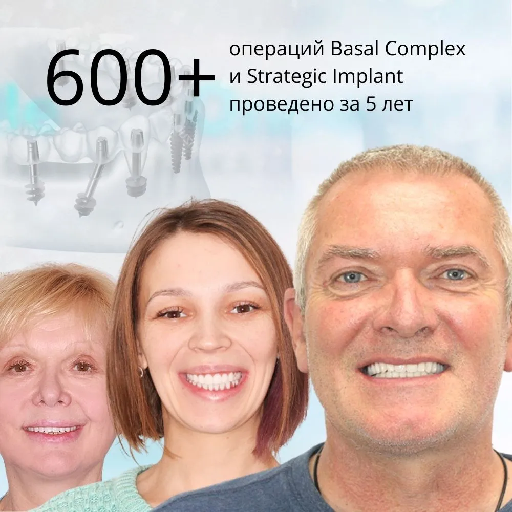 более 600 операций по имплантации зубов
