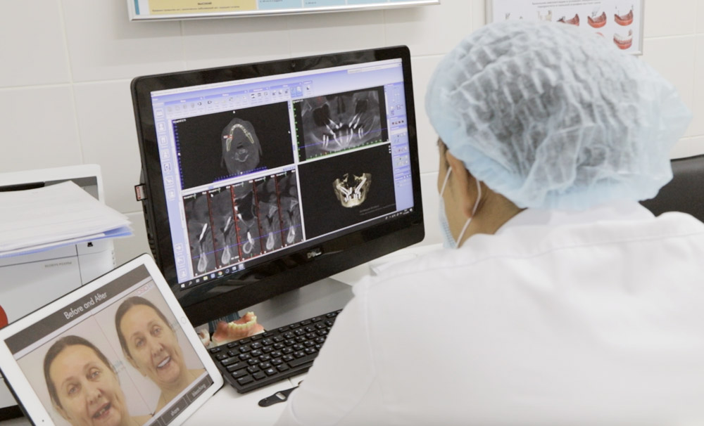 цифровые технологии при имплантации