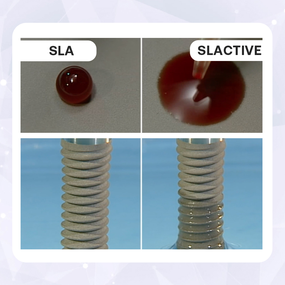 разница между поверхностями sla и slactive