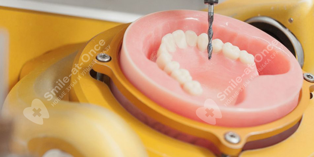 зуботехническая лаборатория smile-at-once
