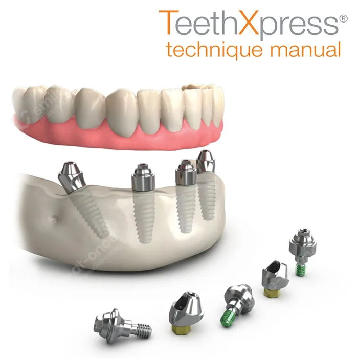 Протокол имплантации TeethXpress