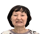 Вера до проведения имплантации зубов