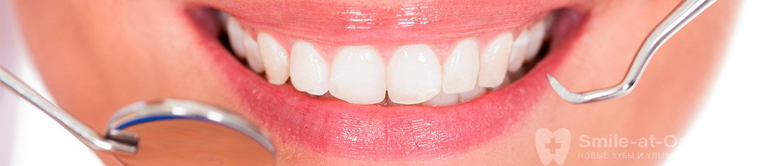 Укрепление эмали зубов
