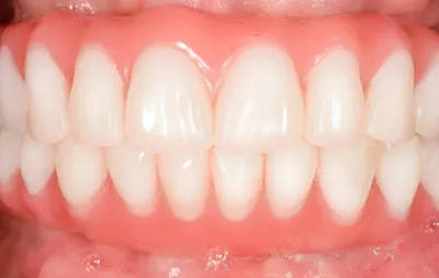 фото после лечения зубов