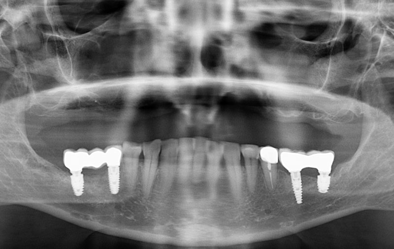 Снимок Фото состояния зубов пациента до операции