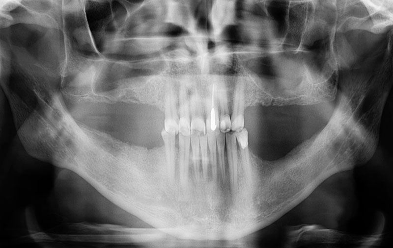 Снимок Фото состояния зубов пациента до операции