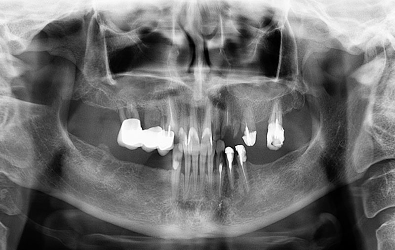 Снимок Фото зубов пациента на первом приеме в клинике