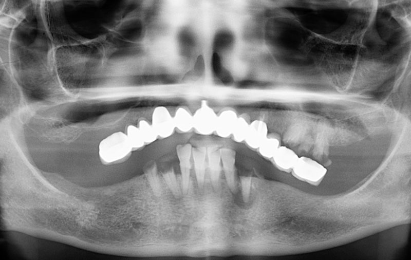 Снимок Фото проблемы с зубами у пациента до лечения
