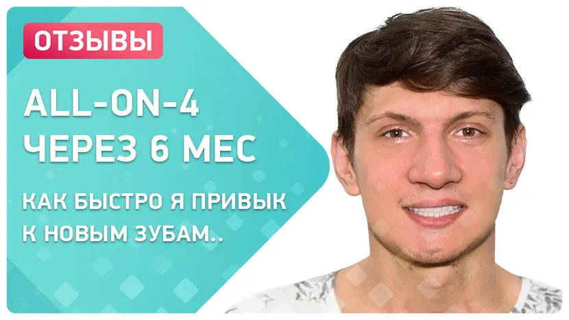 Видео - Отзыв об имплантации all-on-4® Nobel Biocare – как исполняются мечты