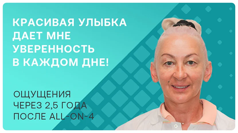Видео отзыв через 2,5 года после имплантации всех зубов