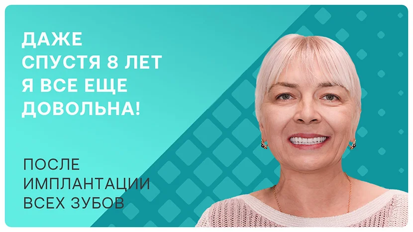 Видео-отзыв пациентки через 8 лет после имплантации всех зубов