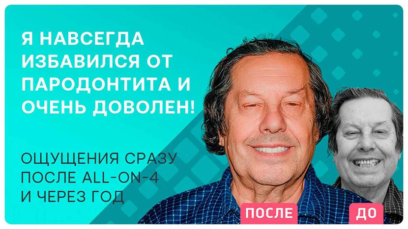 Видео отзыв имплантация всех зубов all-on-4
