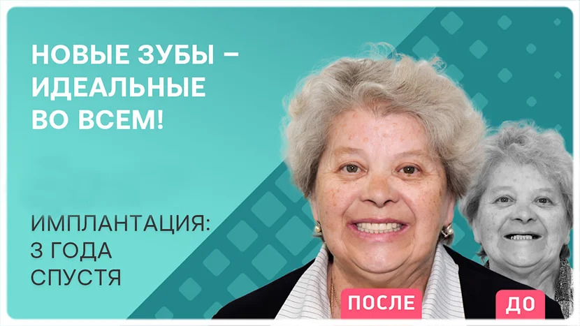 Видео после базальной имплантации зубов