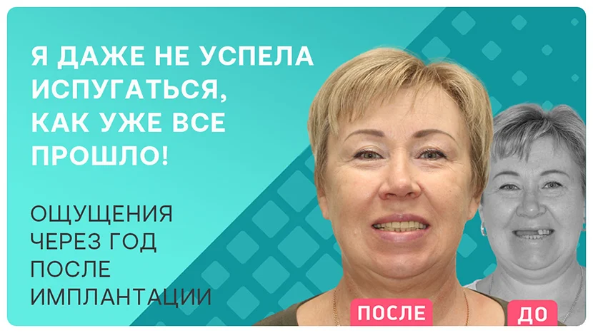 Видео через год после имплантации зубов верхней челюсти