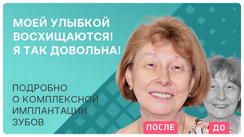 Видео отзыв после проведения комплексной имплантации зубов