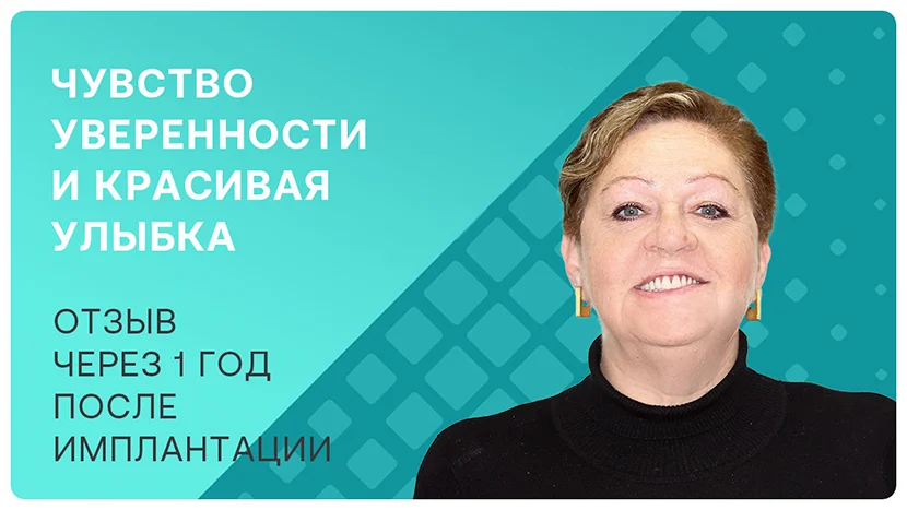 Видео-отзыв через 1 год после имплантации зубов
