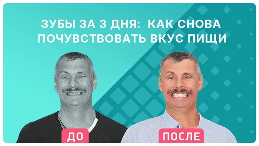 Видео-отзыв сразу после комплексной имплантации зубов