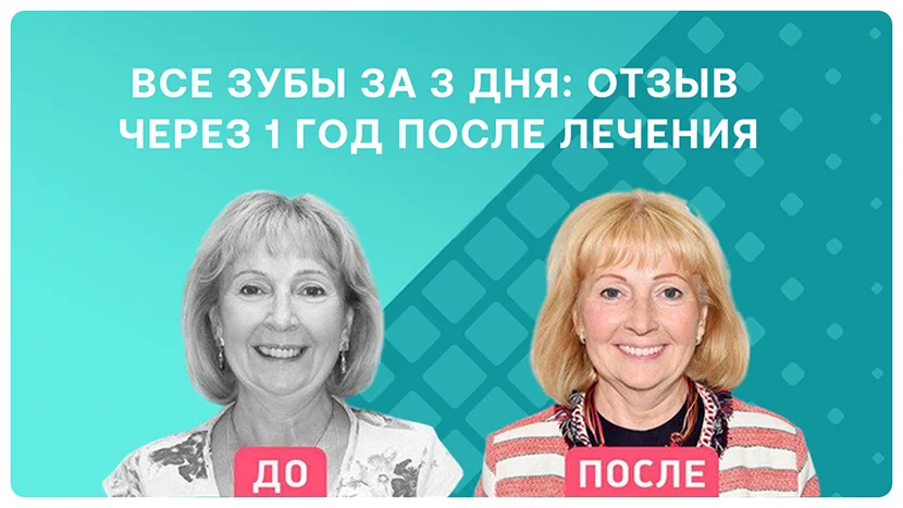 Видео-отзыв как быстро приживаются односоставные импланты