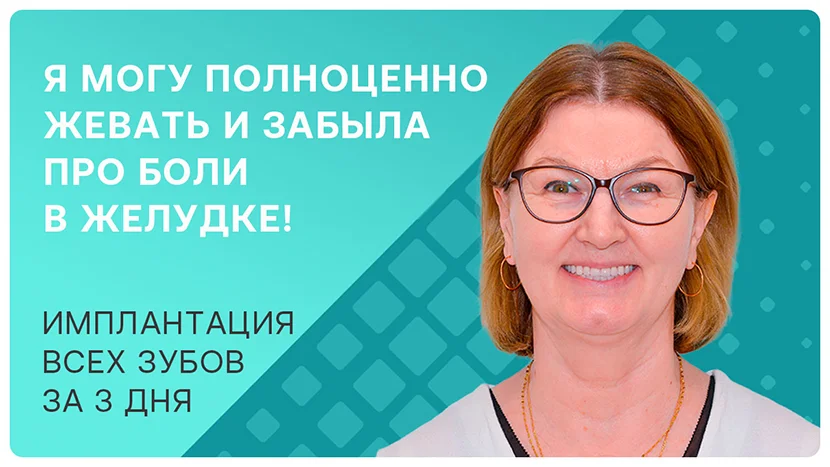 Видео отзыв ощущения после имплантации и протезирования всех зубов