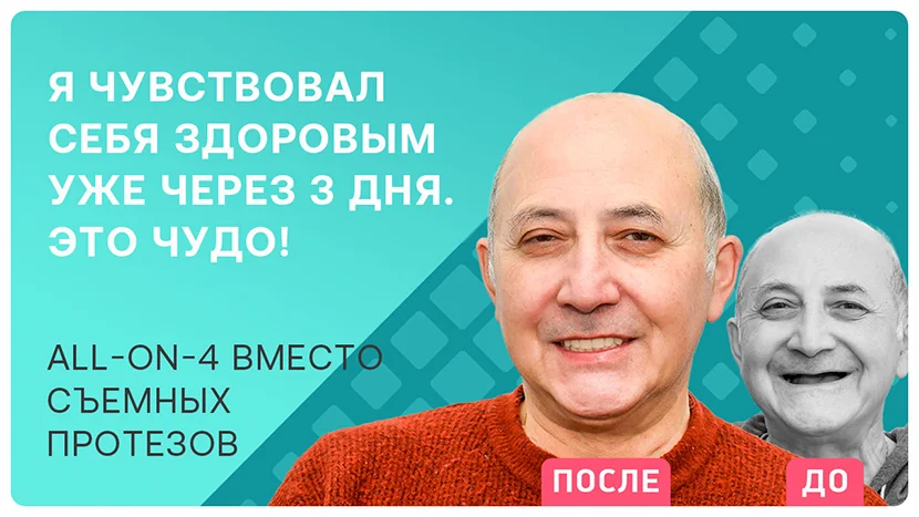 Видео отзыв после имплантации all-on-4 при отсутствии всех зубов