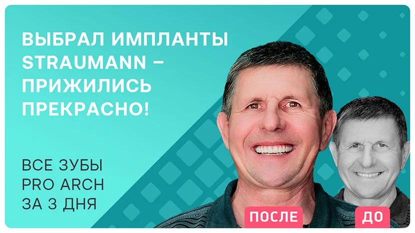 Видео-отзыв после комплексной имплантации зубов Straumann