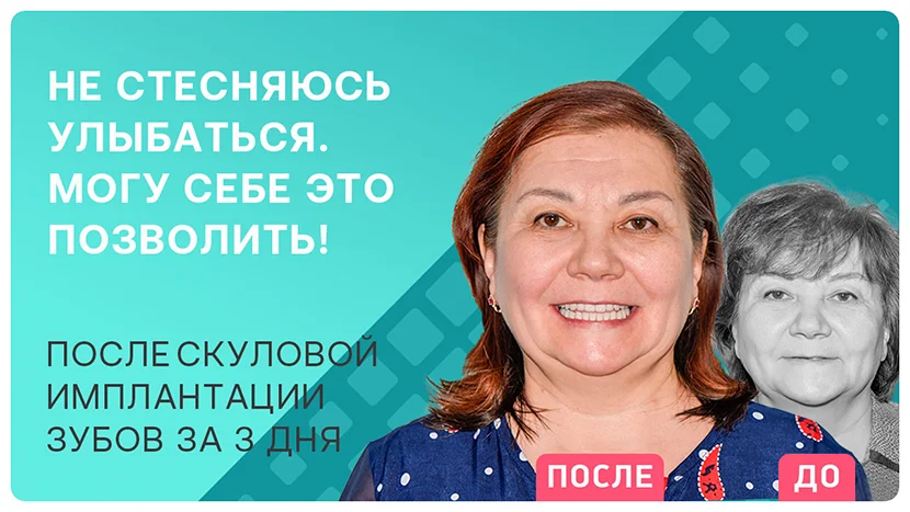 Видео отзыв о решении проблемы с зубами всего за 3 дня