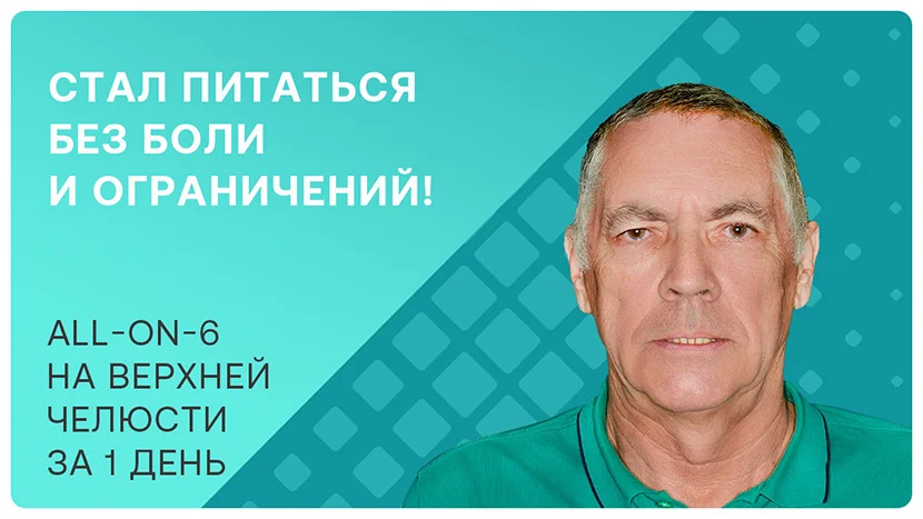 Видео-отзыв через 8 месяцев после имплантации