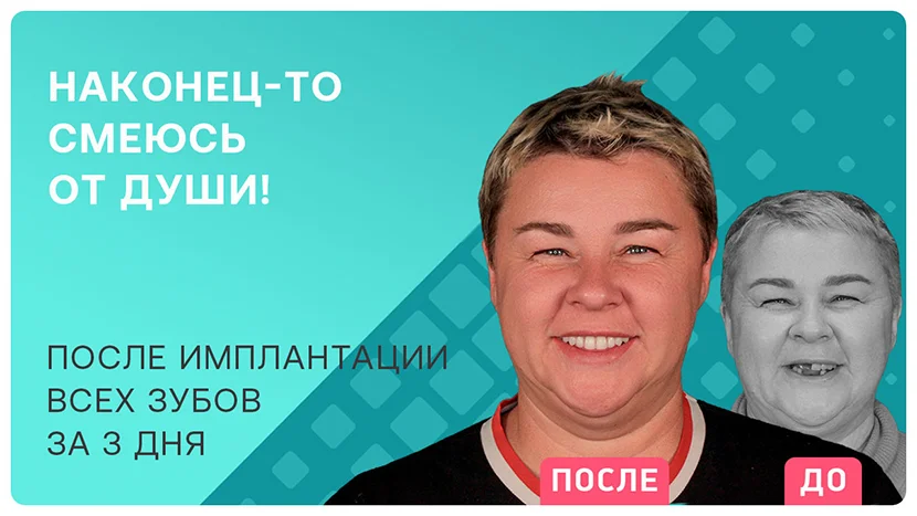 Видео отзыв после имплантации зубов Straumann Pro Arch