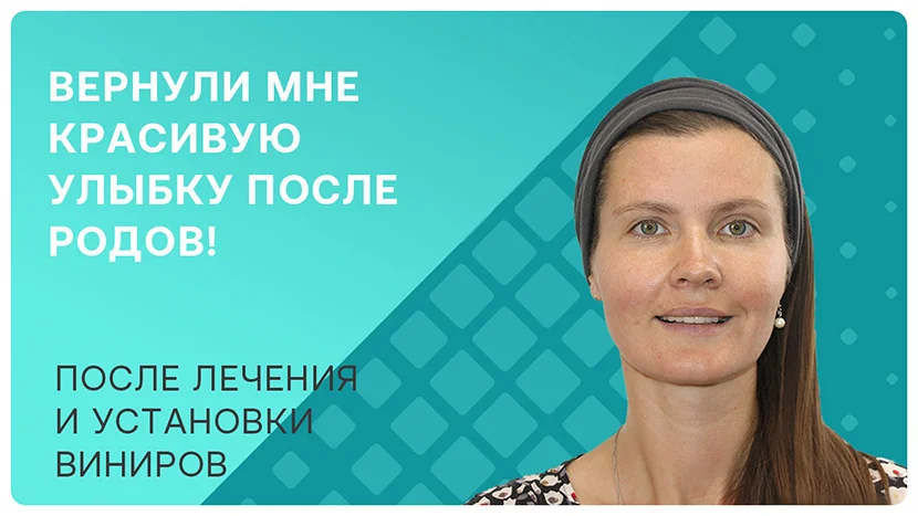 Видео про установку виниров e.max для красивой улыбки