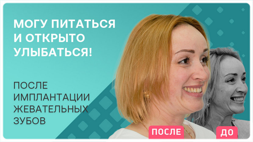 Видео отзыв после имплантации жевательных зубов