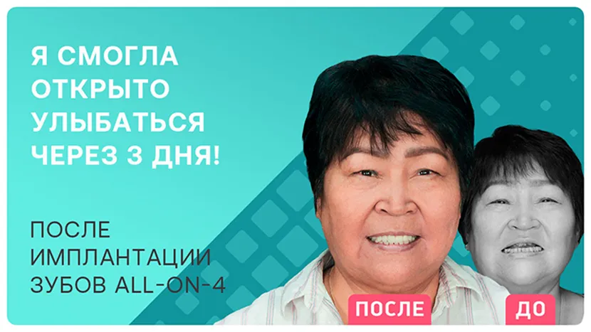Видео отзыв и откровенные признания пациентки после all-on-4