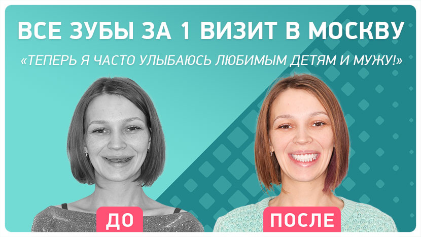 Видео-отзыв через 2 года после комплексной имплантации