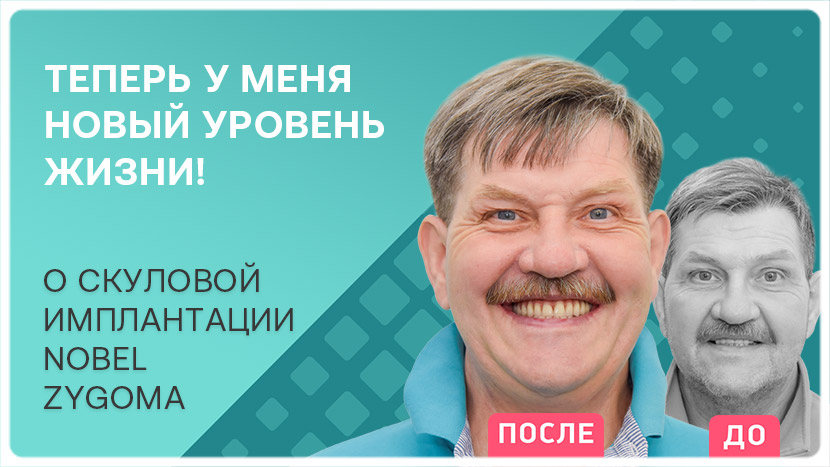 Заставка видео о имплантации