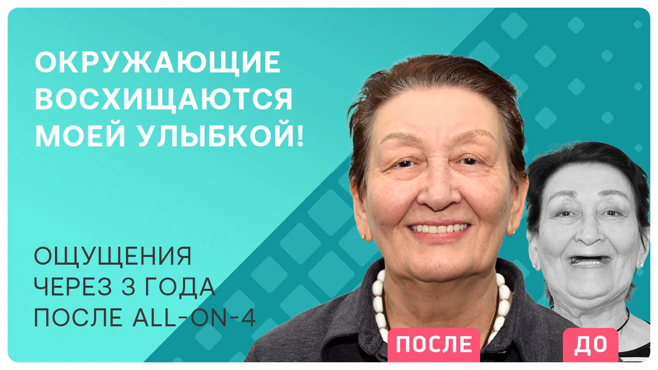 Видео отзыв об имплантации all-on-4 через 3 года