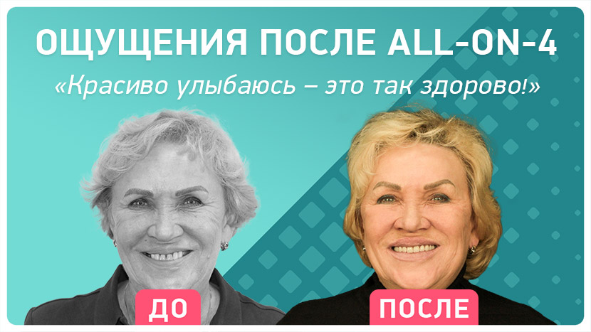 Видео-отзыв о мгновенном омоложении после имплантации зубов