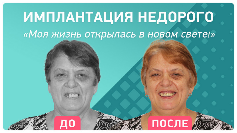 Видео через 6 месяцев после имплантации