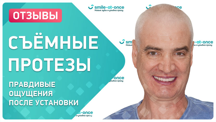 Видео-отзыв через год после протезирования