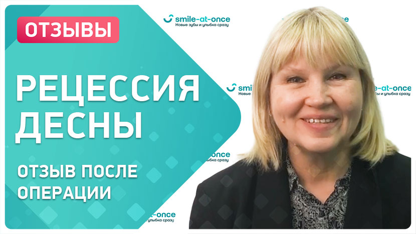 Видео-отзыв после хирургического лечения рецессии десны 