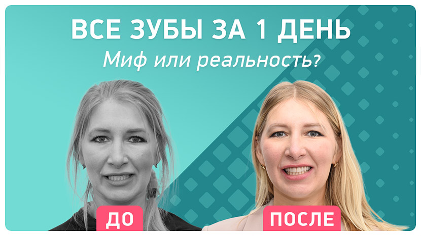 Видео-отзыв через 1 год после имплантации зубов