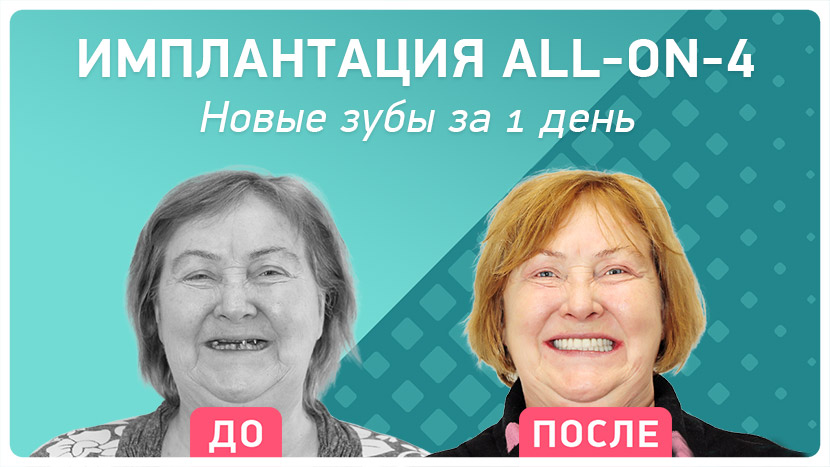 Видео-отзыв через 9 месяцев после перепротезирования