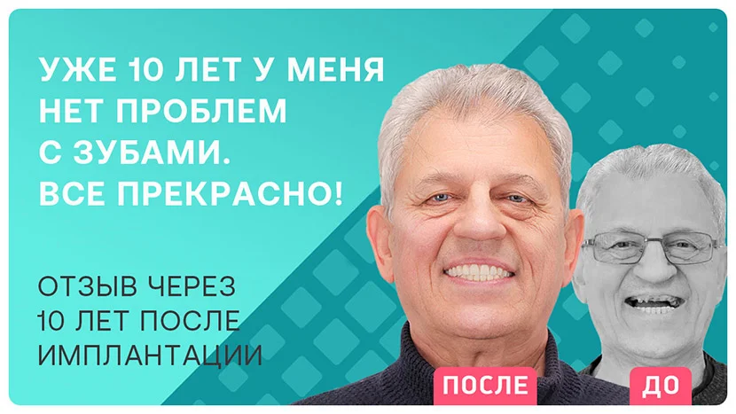 Видео отзыв через 10 лет после имплантации зубов