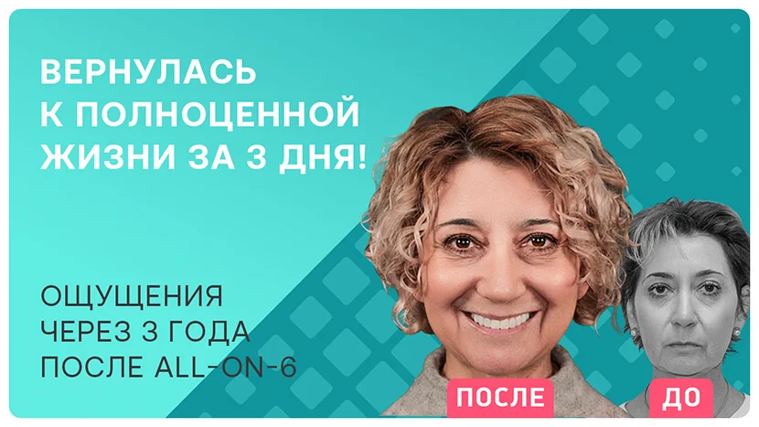 Видео-отзыв через 3 года после имплантации всех зубов