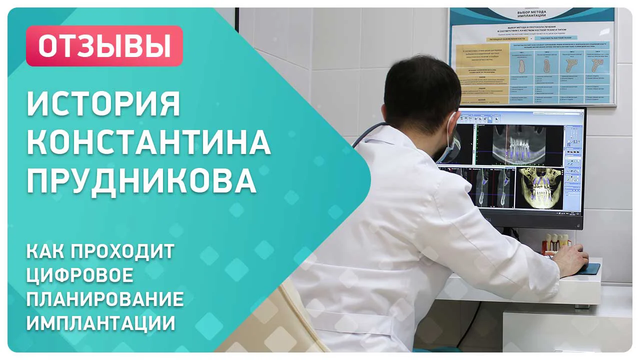 Видео отзыв о планировании операции по установке зубных имплантов