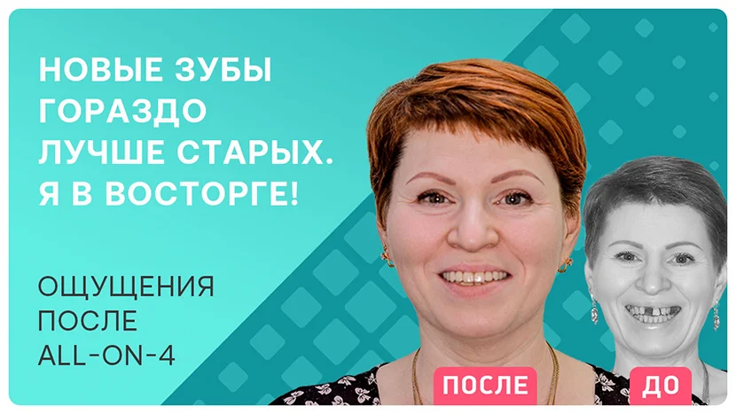 Видео отзыв и полезные советы тем, кто собирается восстанавливать зубы